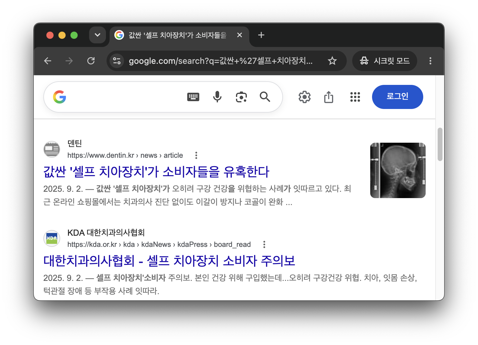 시판 마우스피스 사용 후기를 정리한 화면.